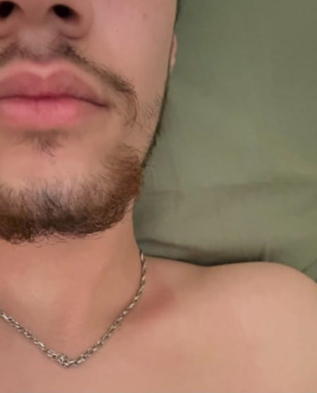 Drew